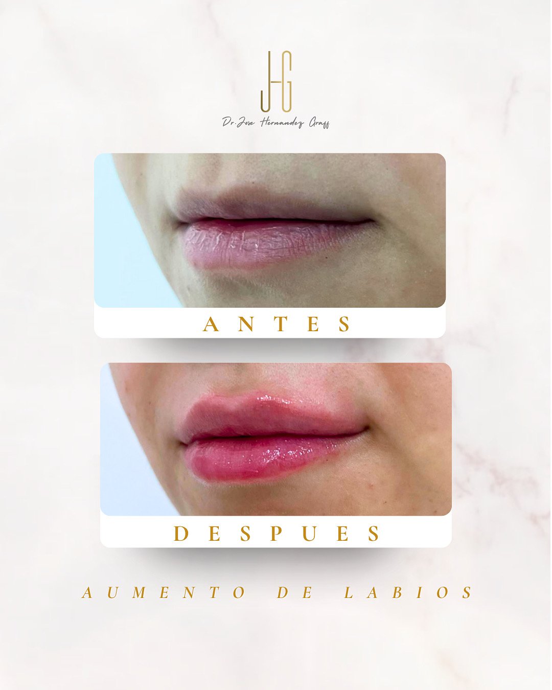 tratamiento antiarrugas - 24