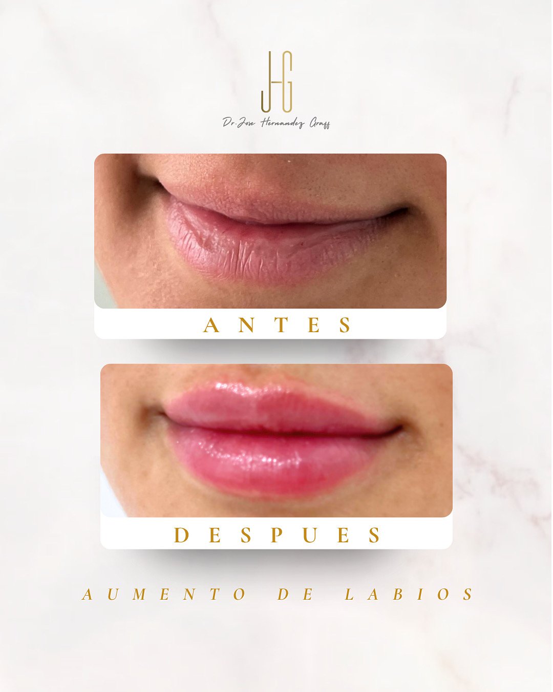tratamiento antiarrugas - 23