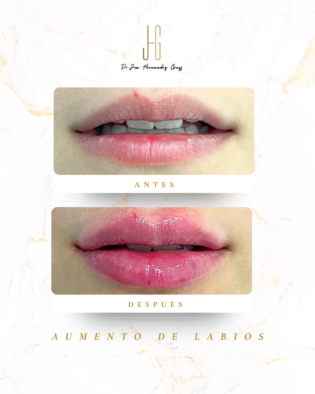 tratamiento antiarrugas - 8